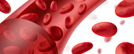 Anemia da carenza di ferro: cause, sintomi e rimedi naturali